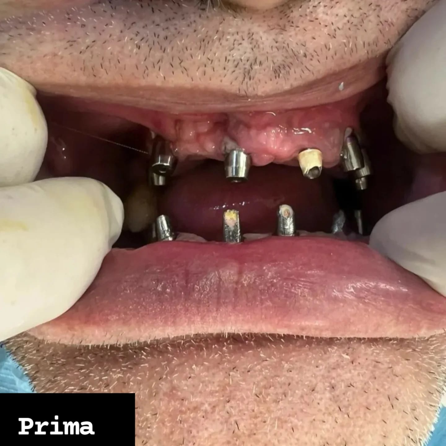Prima del trattamento dentale